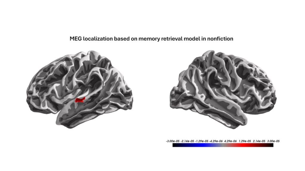 Brain scan (MEG) showing localization of memory retrieval while processing narrative prose.